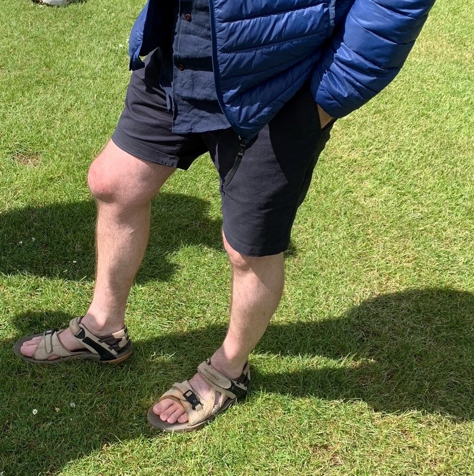 22Anc2 Digby Knee